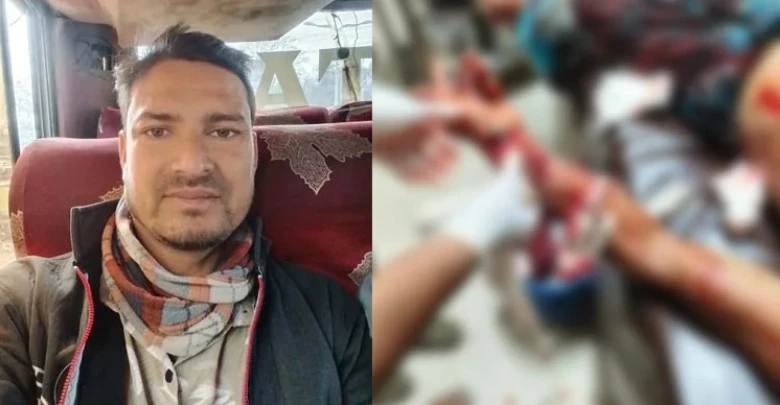 যুবদল নেতার হাতের কবজি কাটল আ. লীগ নেতা